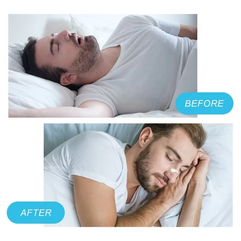 Snore-Free Travel Kit